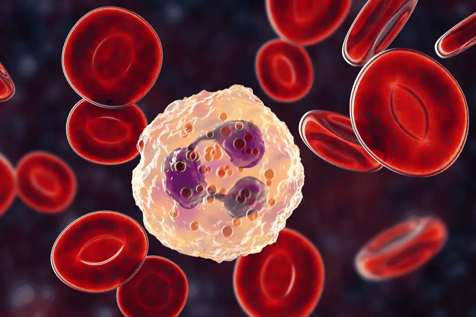 What Does a High Neutrophil Count Mean?