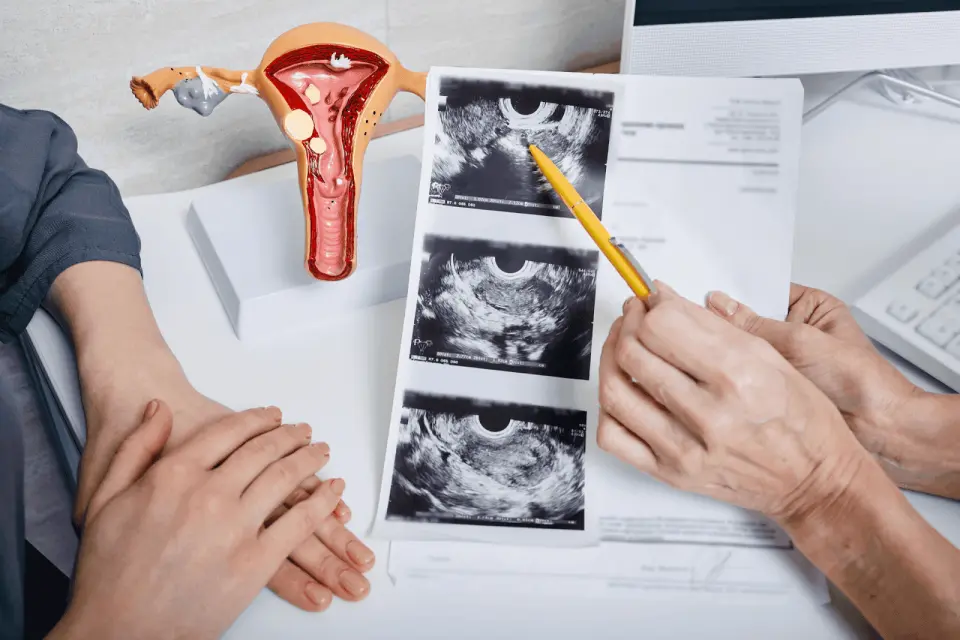 Can a Gynecologist Prescribe Ozempic for PCOS?