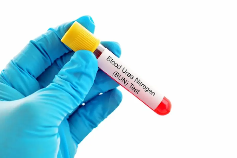 Understanding Your BUN/Creatinine Ratio