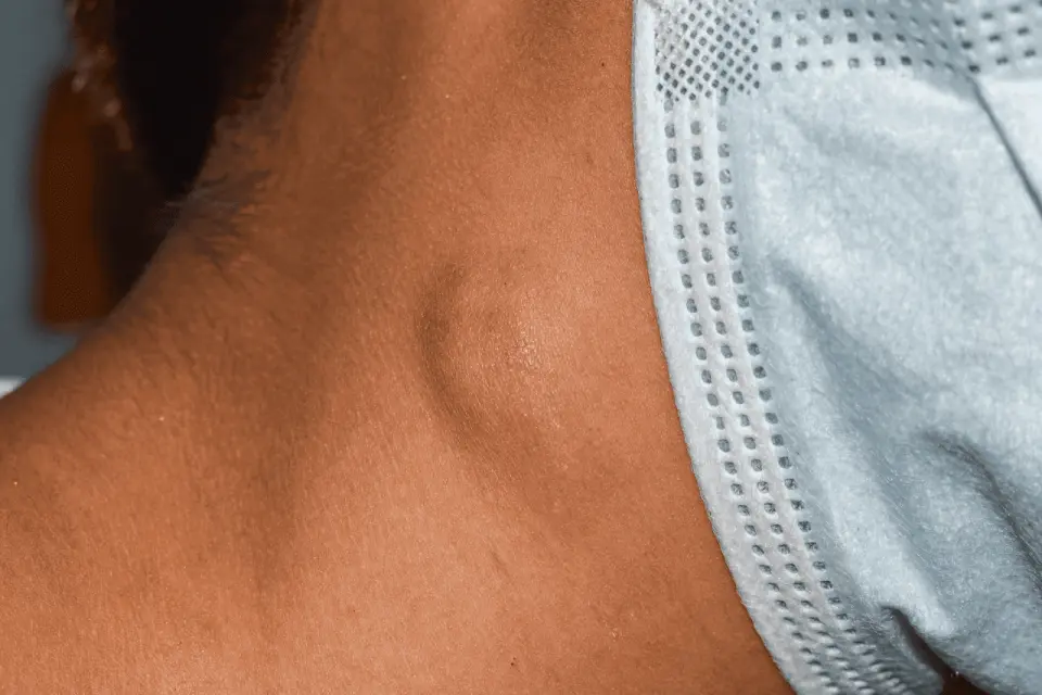 Lump Under Jaw or Chin: Causes, Red Flags & When to Seek Care