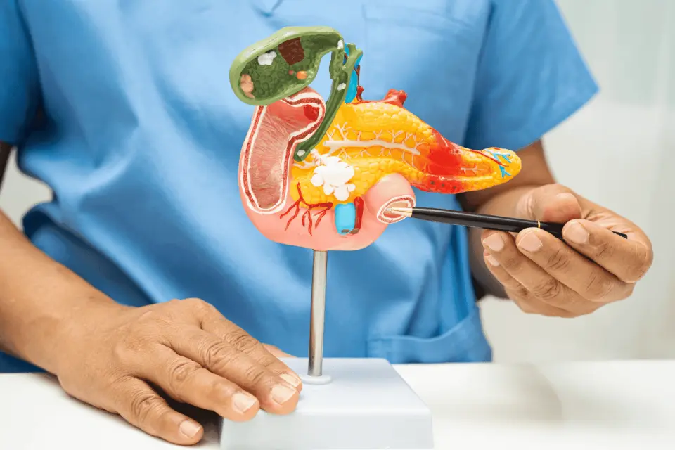 Struggling With Digestion? It Might Be EPI - Here's How to Tell