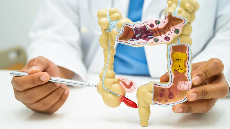 Can Urgent Care Diagnose Appendicitis? What to Know Before You Go