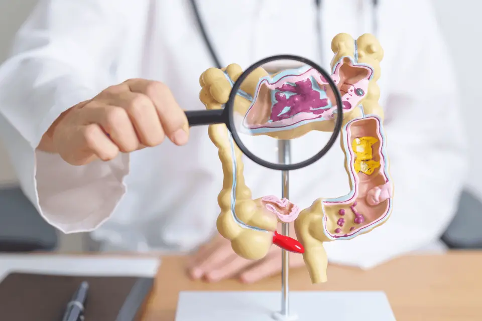 Constant Bloating or Cramping? It Could Be IBS