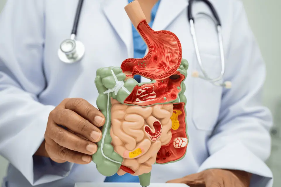 Bowel Problems That Won’t Go Away? Here’s What to Check