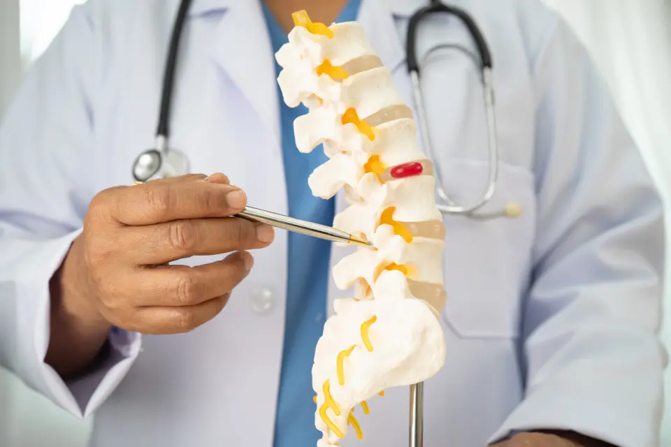 Scoliosis of the Spine Explained
