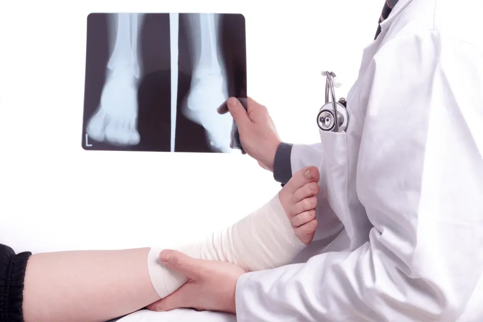 Sprained Foot vs. Broken Foot: Key Differences and What to Do Next