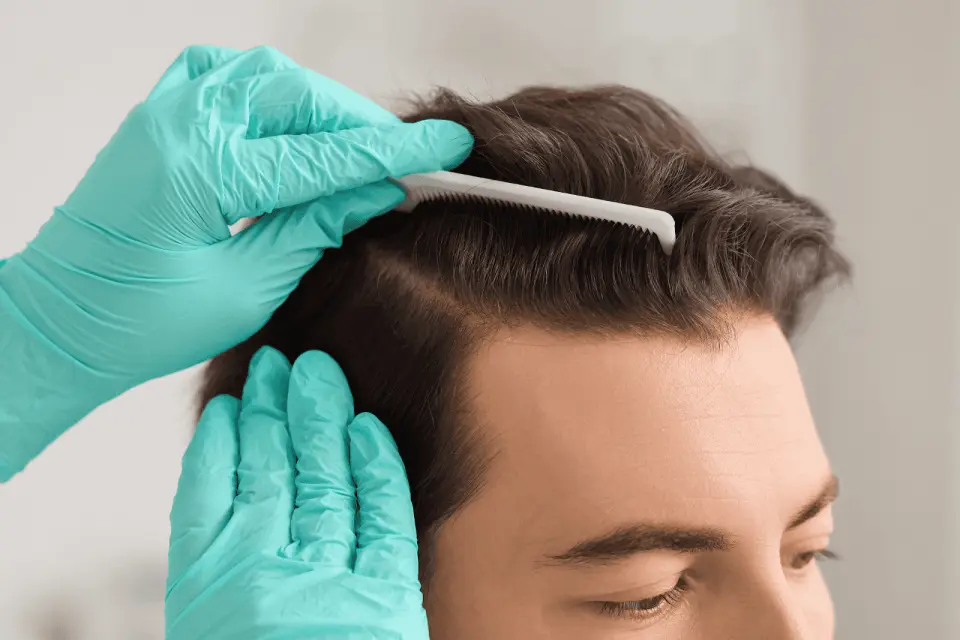 Does Tirzepatide Cause Hair Loss?