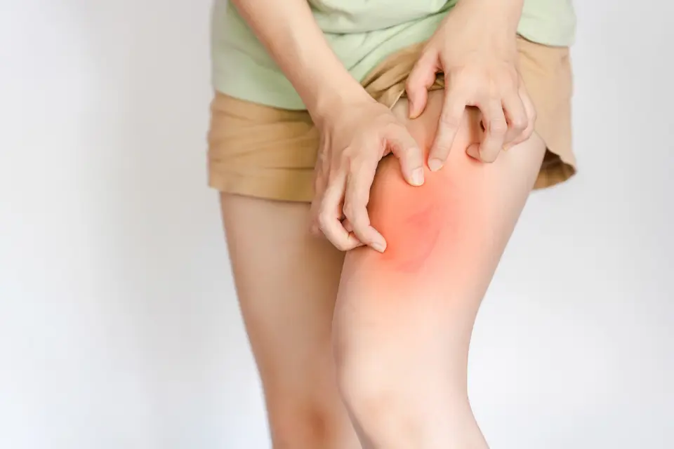 7 Common and Serious Side Effects of Cortizone-10