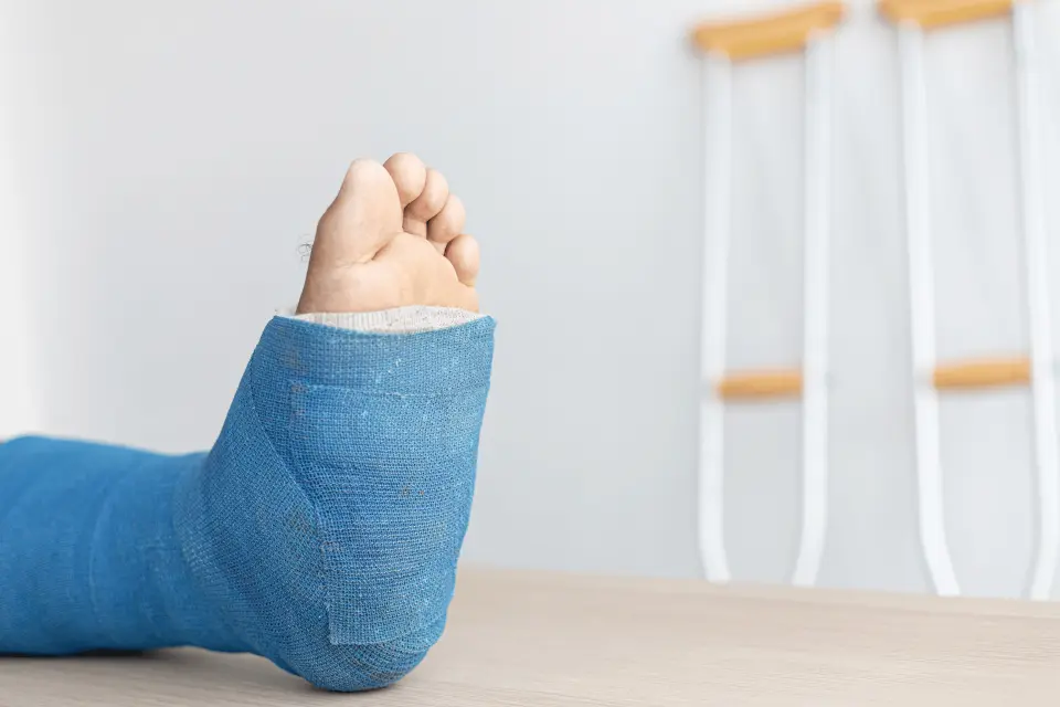 Types of Ankle Fractures: Which Ones Need Surgery?