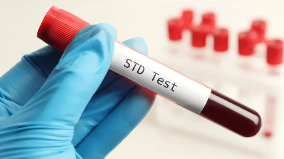 Worried About an STD? Here's How to Check Your Symptoms
