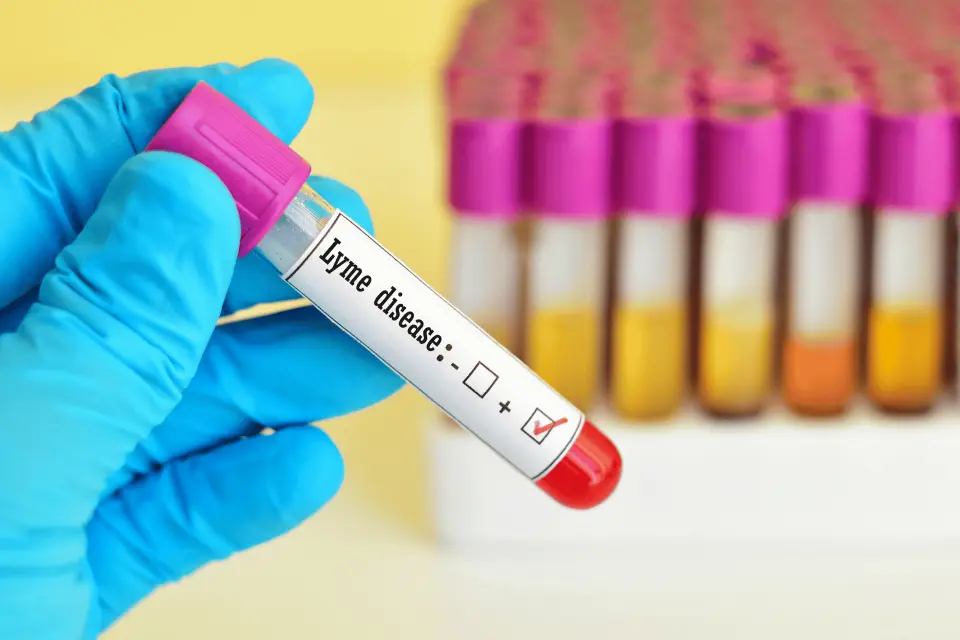Is Lyme Disease Contagious? What You Need to Know