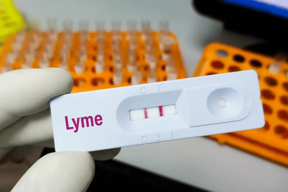 Lyme Disease Testing: How Diagnosis Works and When to Get Tested