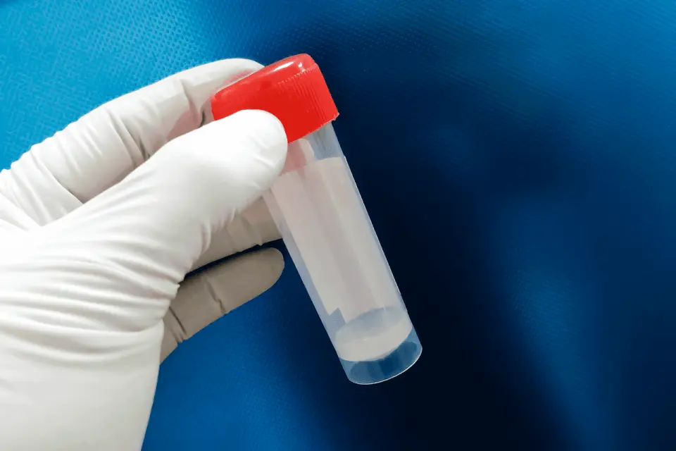 Why Is My Semen Watery? (2026)