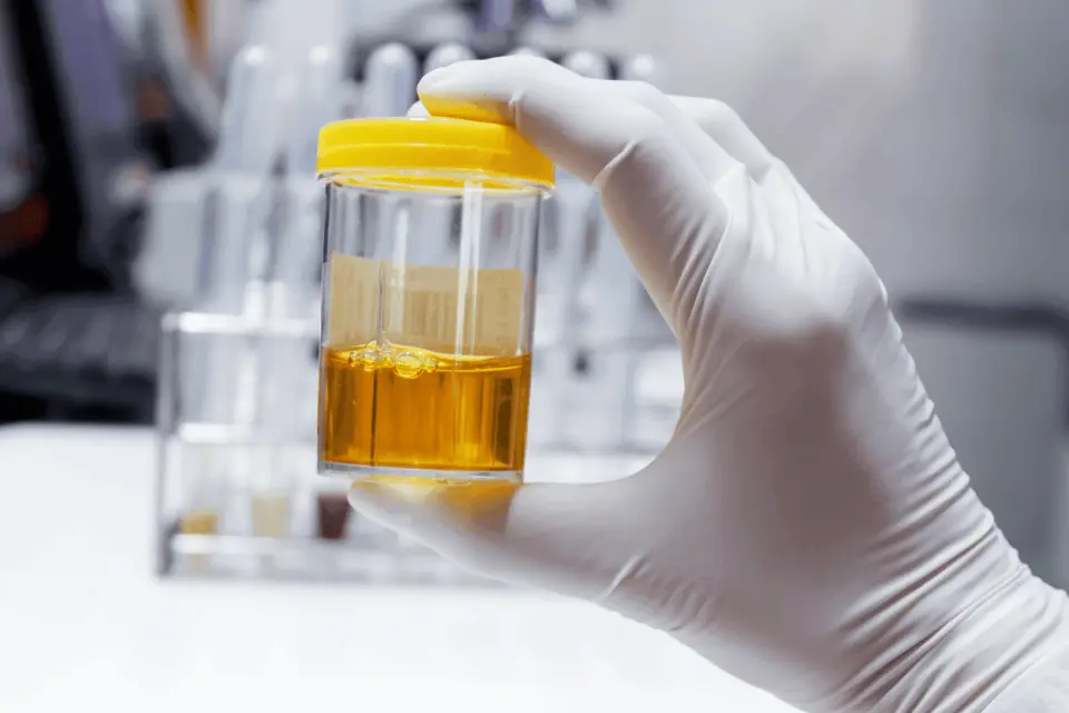 Blood in Your Urine? Here’s What It Could Signal