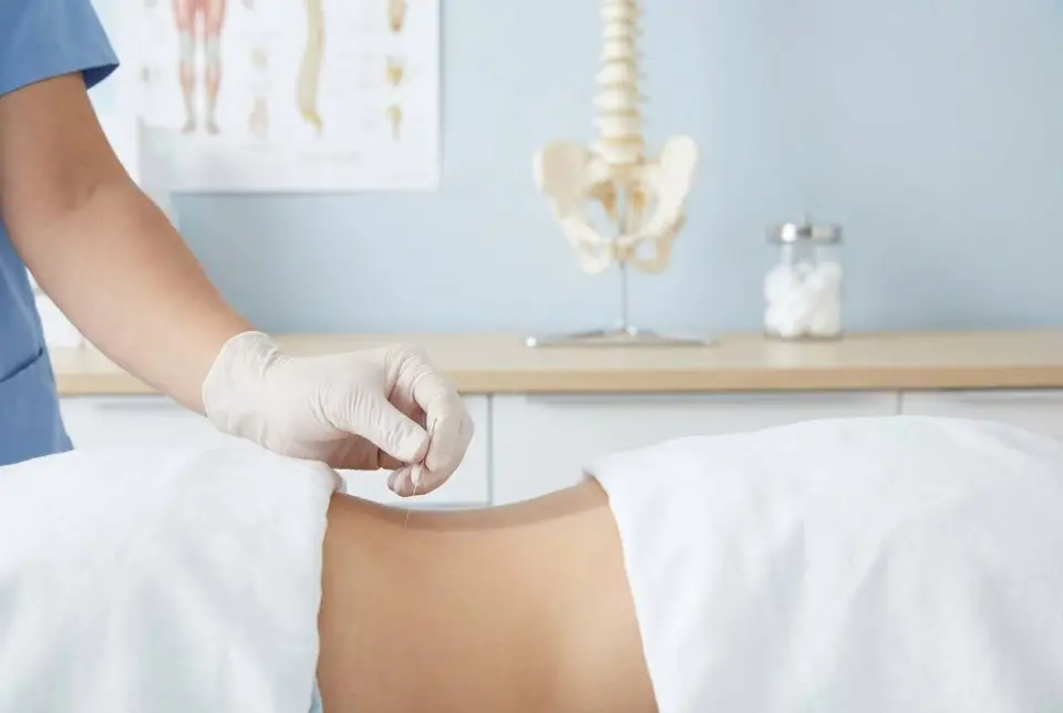 Acupuncture for Sciatica: Does It Work?