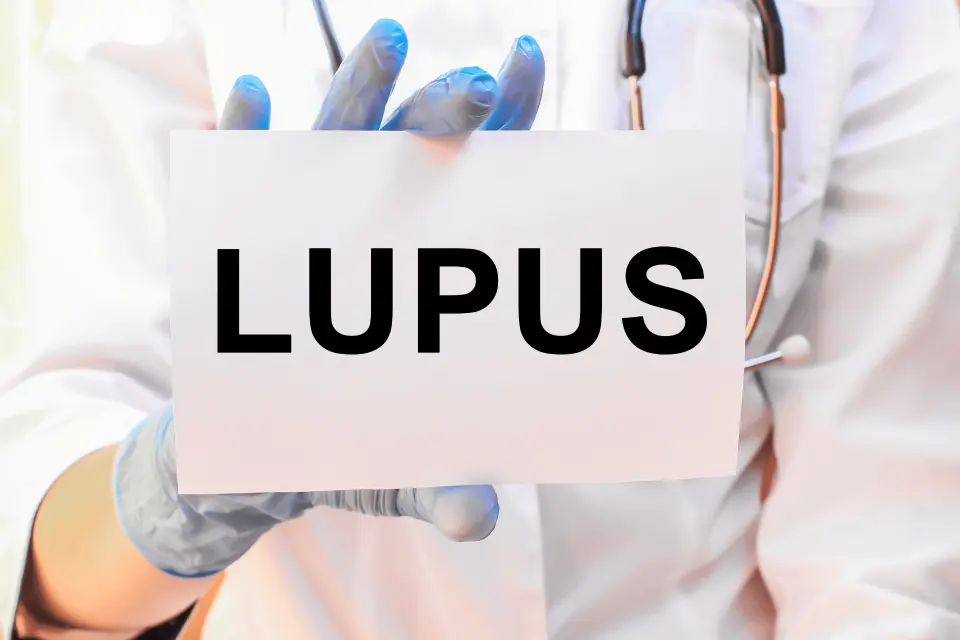 How Lupus Can Cause Hair Loss