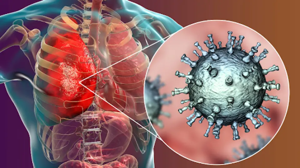 Can Urgent Care Diagnose Pneumonia?