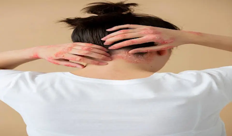 Folliculitis vs Herpes: What’s Causing the Rash?