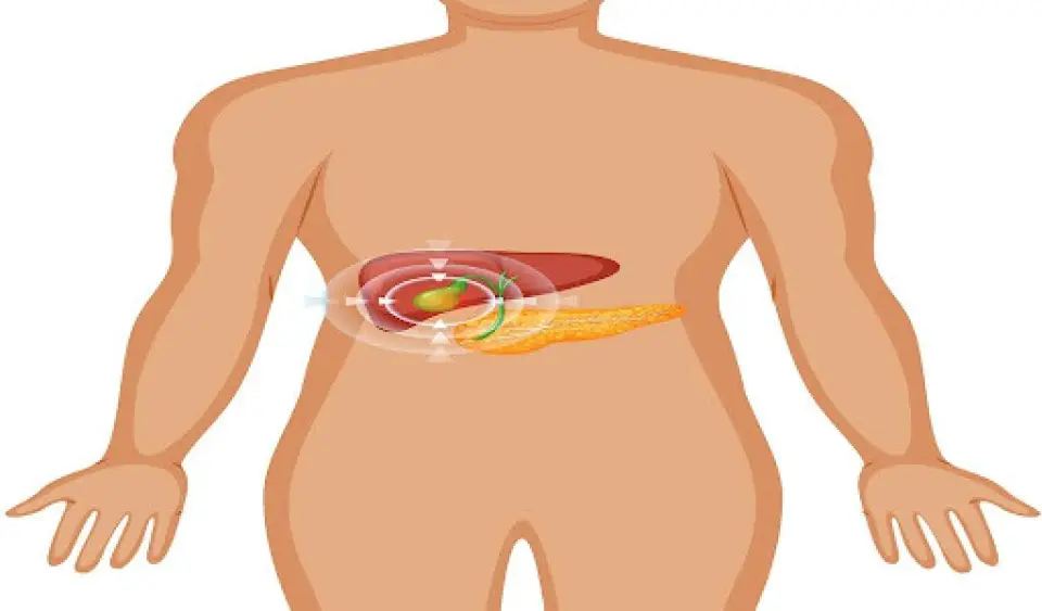 Gallstones vs Kidney Stones: What’s the Difference?