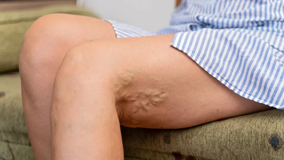 Can Urgent Care Diagnose Blood Clots?
