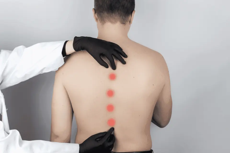 Lordosis of the Spine: Causes and Treatment
