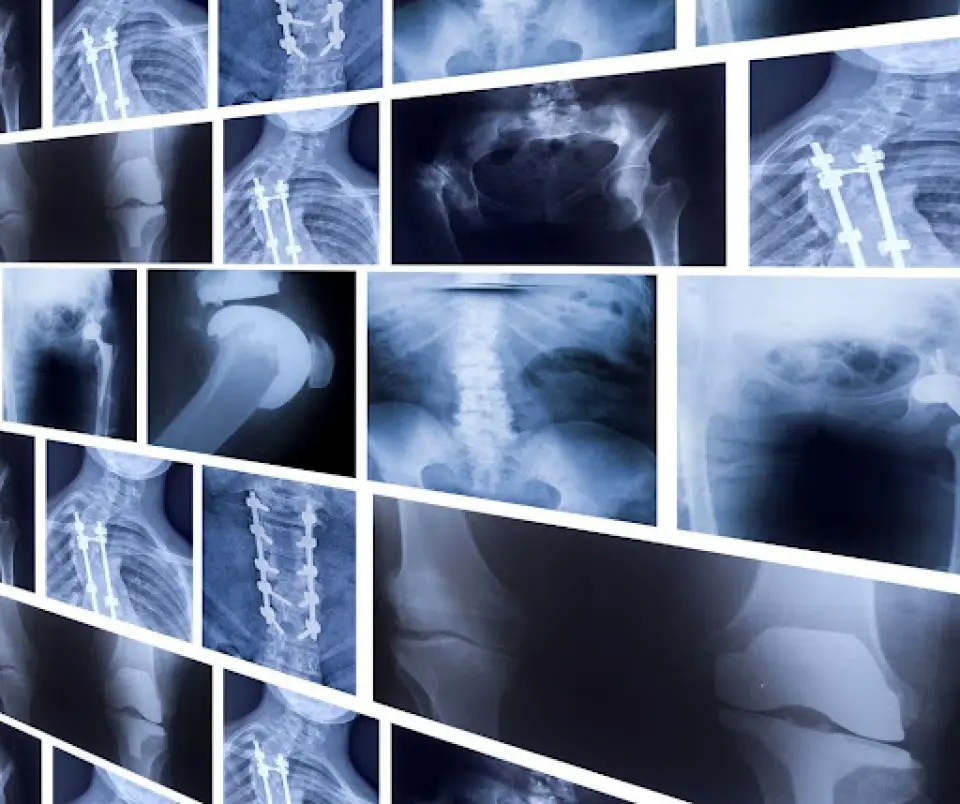 Does Urgent Care Do X-Rays?