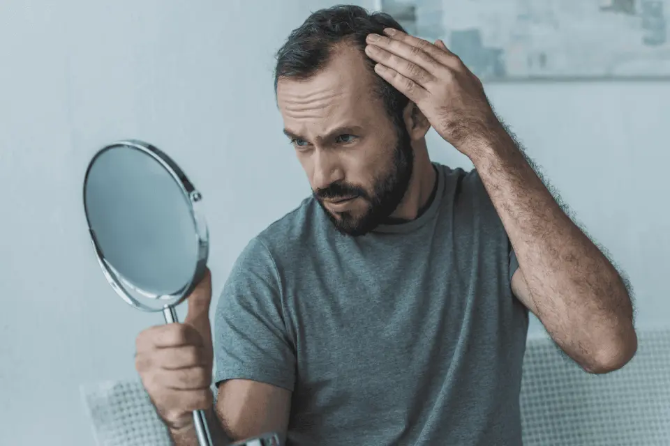 How to Stop Alopecia Areata From Getting Worse