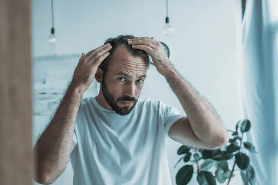 How to Prevent Hair Loss While Taking Testosterone