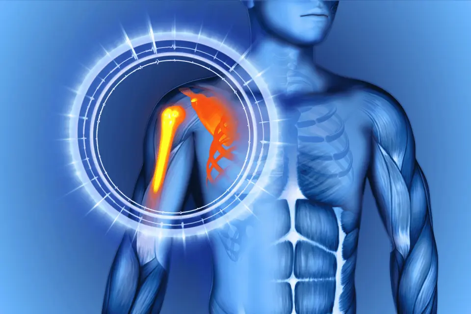 Sore Shoulder? Here’s How to Tell What’s Causing It