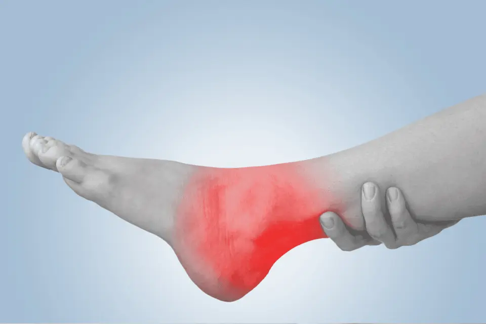 How Long Does a Twisted Ankle Take to Heal?