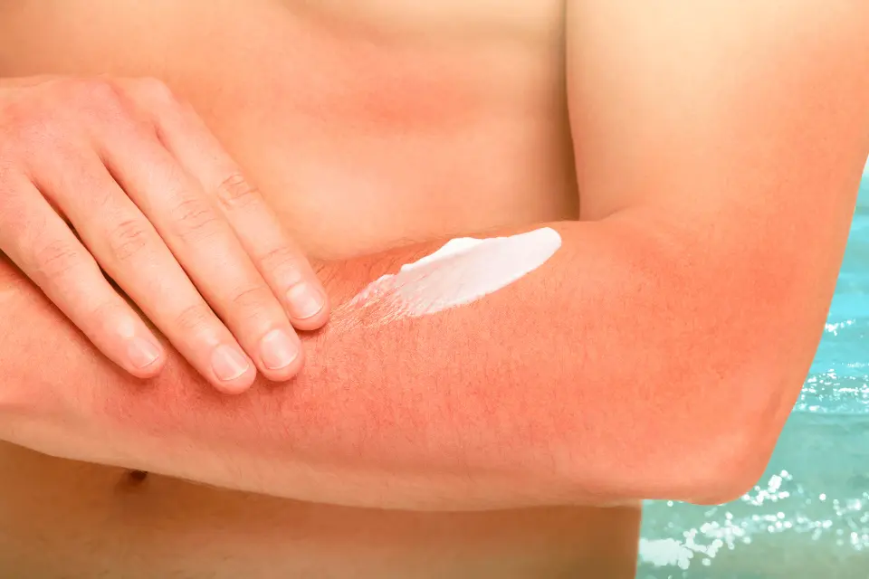 Tretinoin for Sun Damage: How This Prescription Retinoid Repairs Your Skin