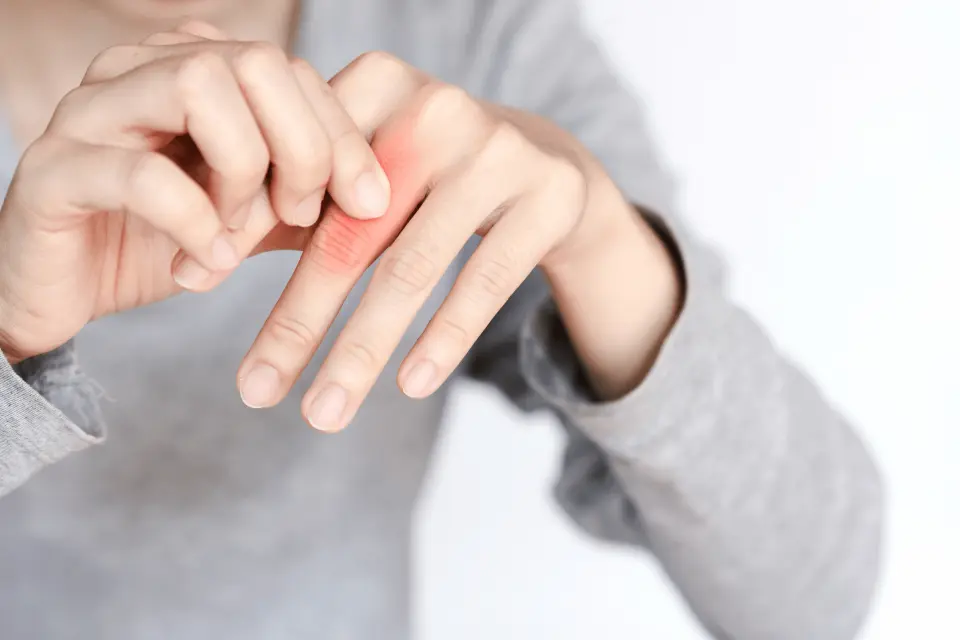 Sprained Finger: How to Treat It and When to Get an X-Ray