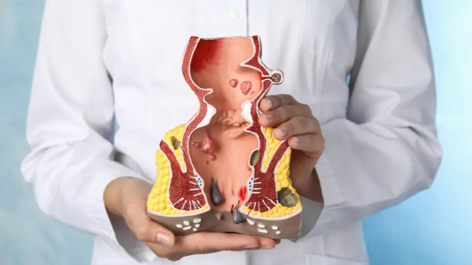 Can Urgent Care Treat Hemorrhoids?