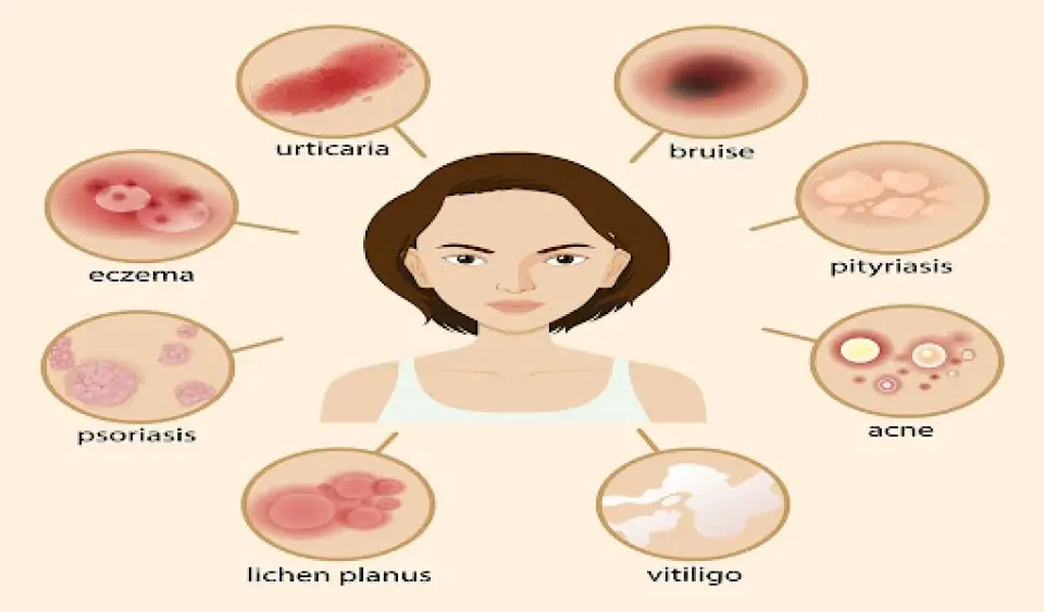 Blood Blister vs Melanoma: How to Tell Them Apart