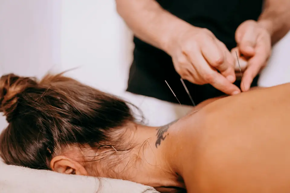 Can Acupuncture Help With Weight Loss?