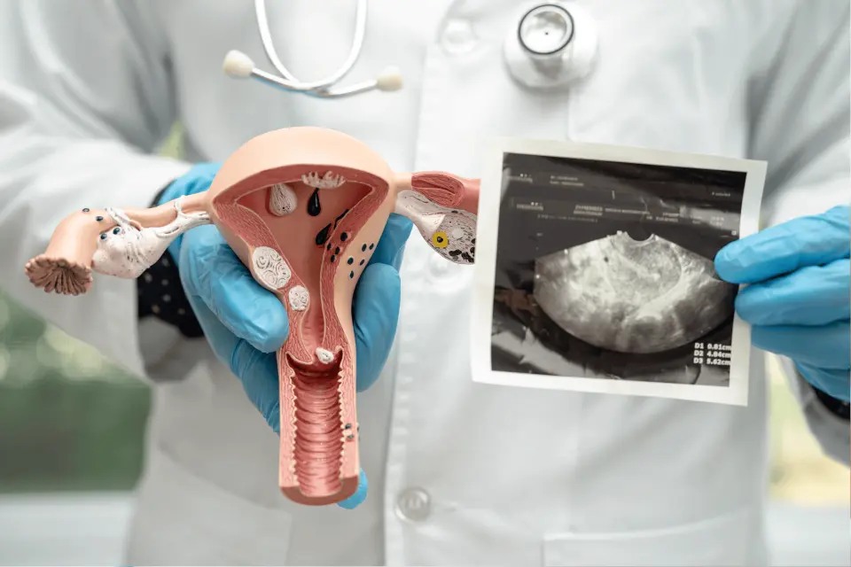 Ozempic for PCOS - Can It Help?