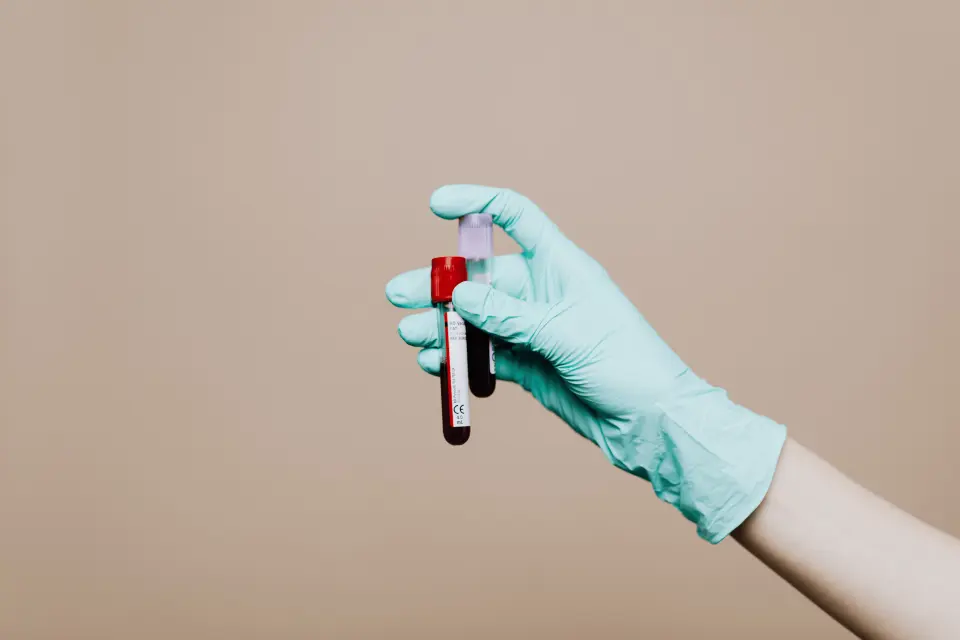 Can Telehealth Order Blood Work for You?