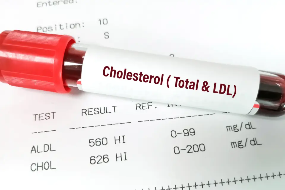 Can High Cholesterol Cause Erectile Dysfunction? The Hidden Link Explained