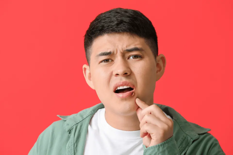 Lysine for Cold Sores: Does It Actually Work?