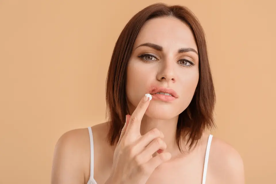 Cold Sore Medicines: A Guide to Over-the-Counter (OTC) and Prescription Treatments