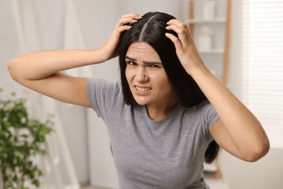 Scalp Eczema: Causes and Treatments for Itchy Scalp