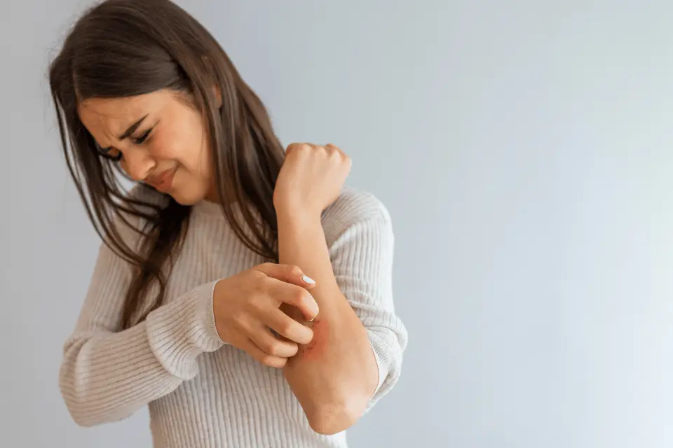 Is Eczema an Autoimmune Disease? Here’s What Science Says