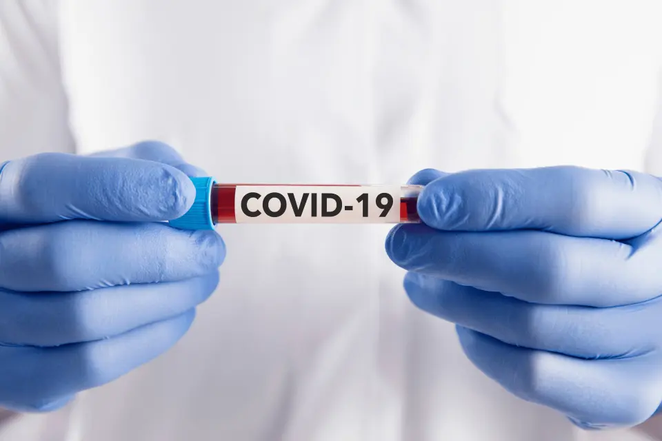 Can COVID-19 Cause Hair Loss?
