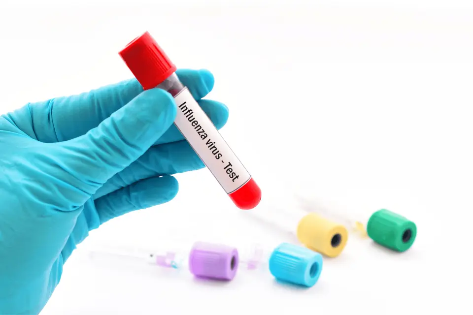 Flu Test: How and When to Get Tested