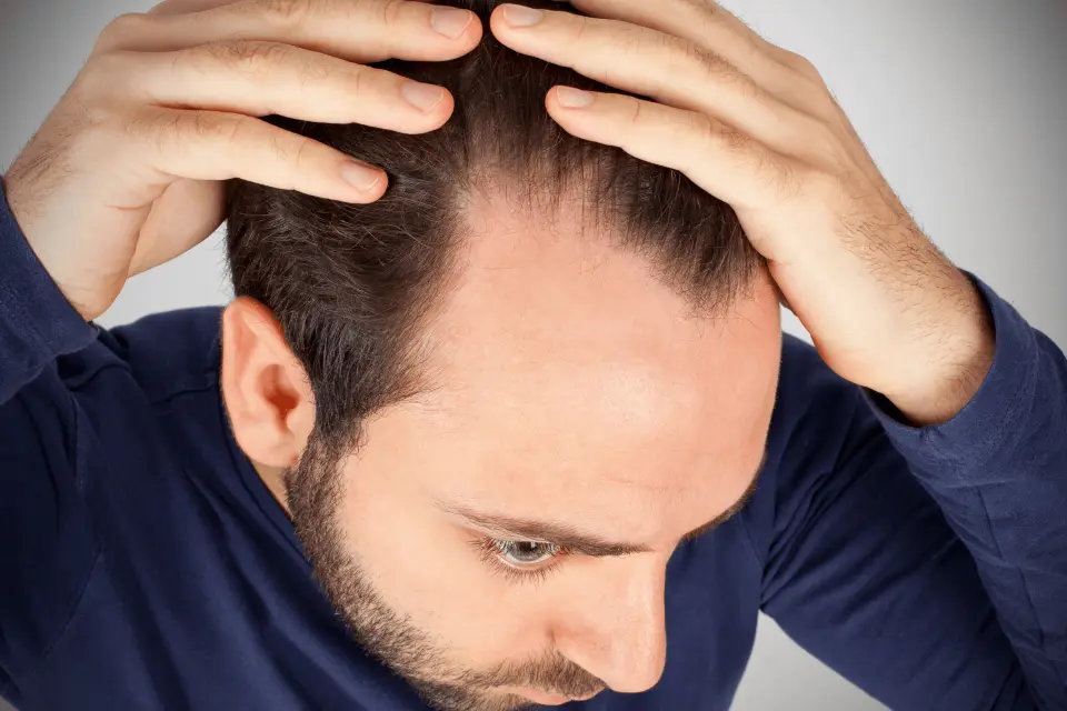 How to Prevent Hair Loss