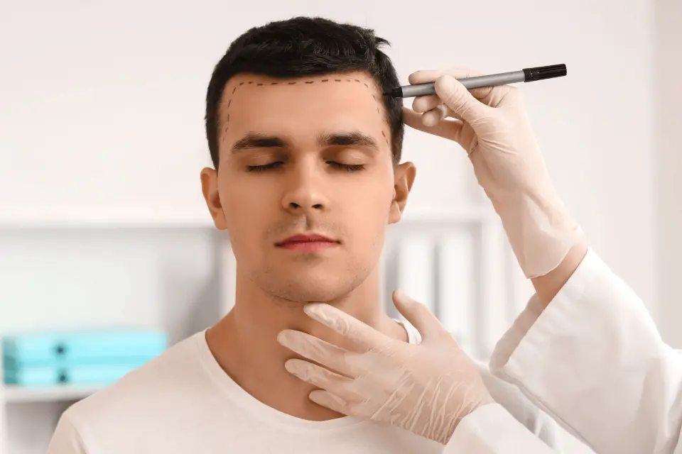 What to Know About Hair Transplants