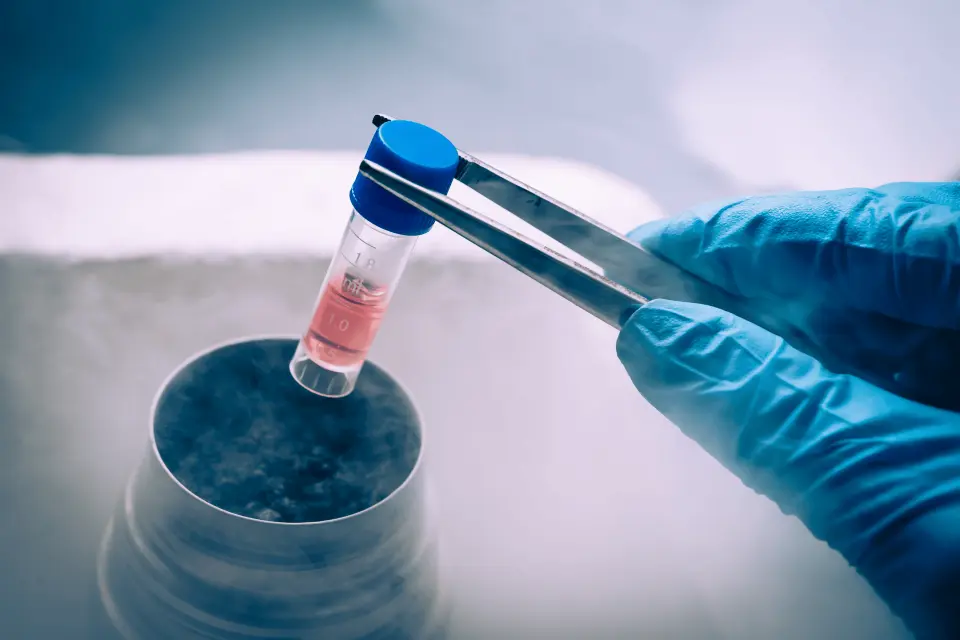 Can Stem Cell Therapy Treat Hair Loss?