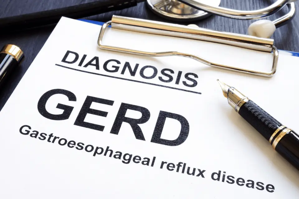 Baclofen for Acid Reflux: What You Should Know