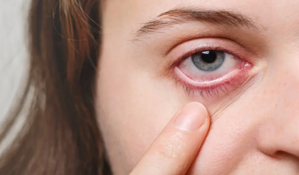 Uveitis vs Conjunctivitis: Eye Inflammation Compared