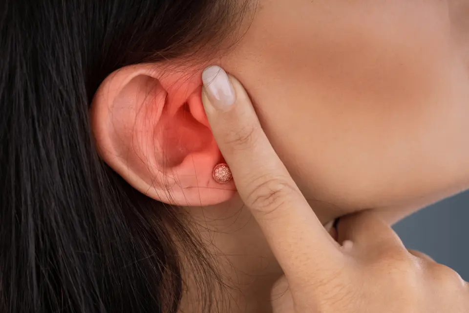 Ear Eczema: How to Manage It Safely